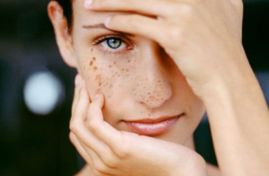 Осветлить-пигментные-пятна-на-лице